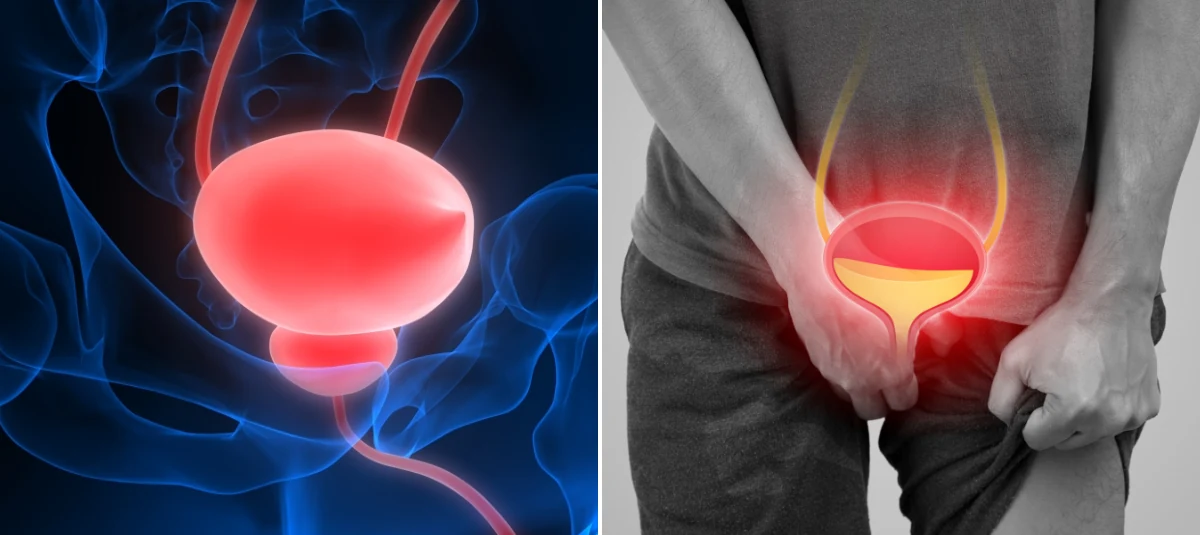 Doctor reviewing a prostate ultrasound scan
